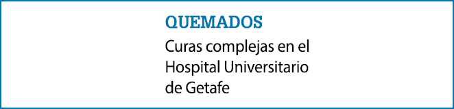 quemados Curas complejas en el Hospital Universitario de Getafe